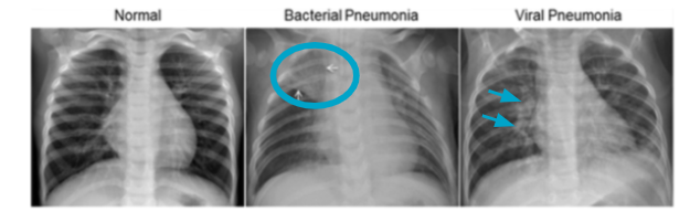 radiology image annotation