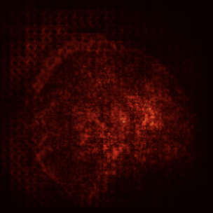 Figure 1: Brain MRI saliency map